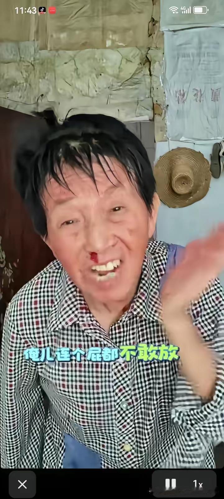 一个婆婆的诉说，儿媳妇打她了，她屁都不敢放，天天给她抱着孩子、洗衣做饭，这婆婆活