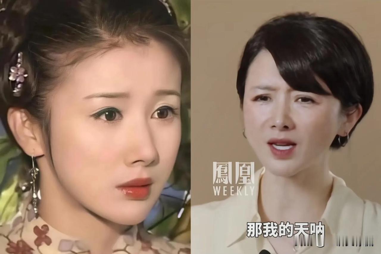 孙菲菲现在的样子给所有女人提了个醒不管你多有钱，不管你多爱美，也千万不要随便