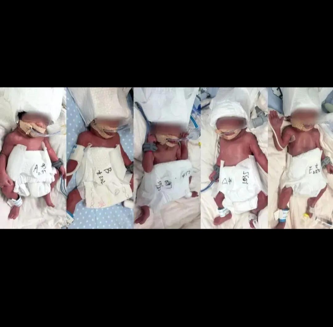 太震撼了!极其罕见!5胞胎（1男4女）今日凌晨在武汉出生，六千万分之一概率！