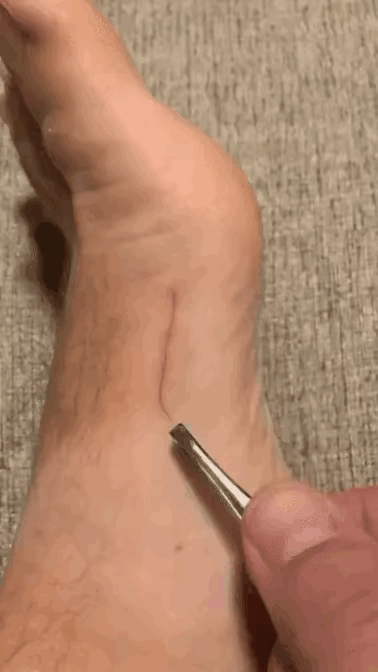 我一直很好奇，这是怎么进去的。