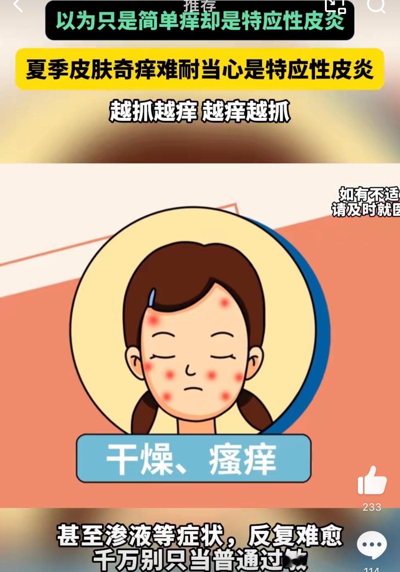 夏季皮肤奇痒难耐当心是特应性皮炎以前都没有想到原来是这个皮炎的问题，我还以为