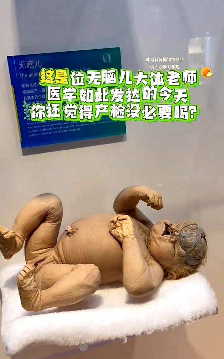 这是位无脑几大体老师。前几天陪闺蜜去产检，看到B超机里扑通扑通的小心脏直接给我