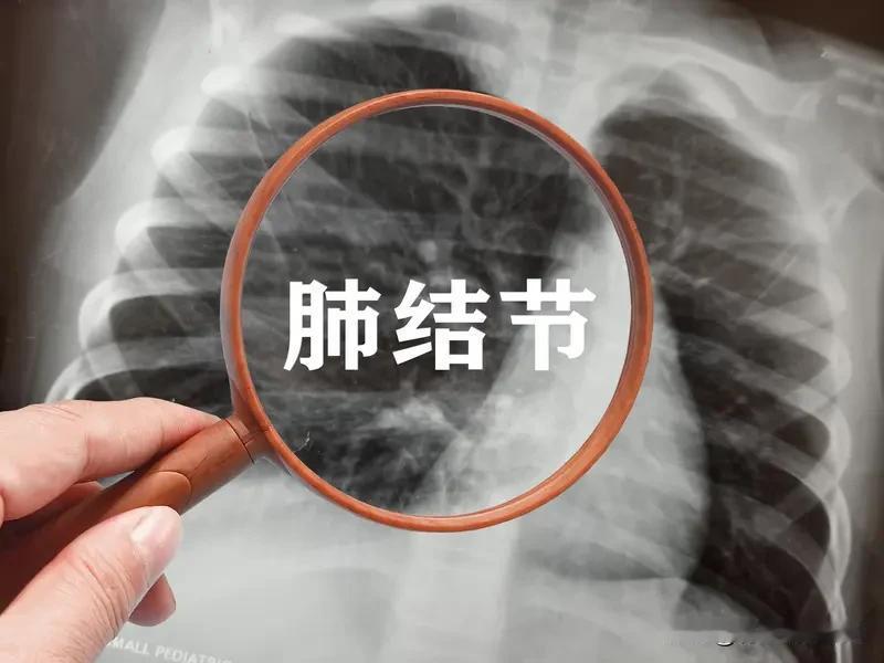 结节不用慌！10个散结中成药，大白话唠明白，不同结节对应选不管是肺上、乳腺