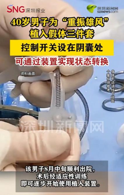 40岁男子为妻子植入“假体三件套”：这不是猎奇，是治病最近深圳一个新闻挺多人