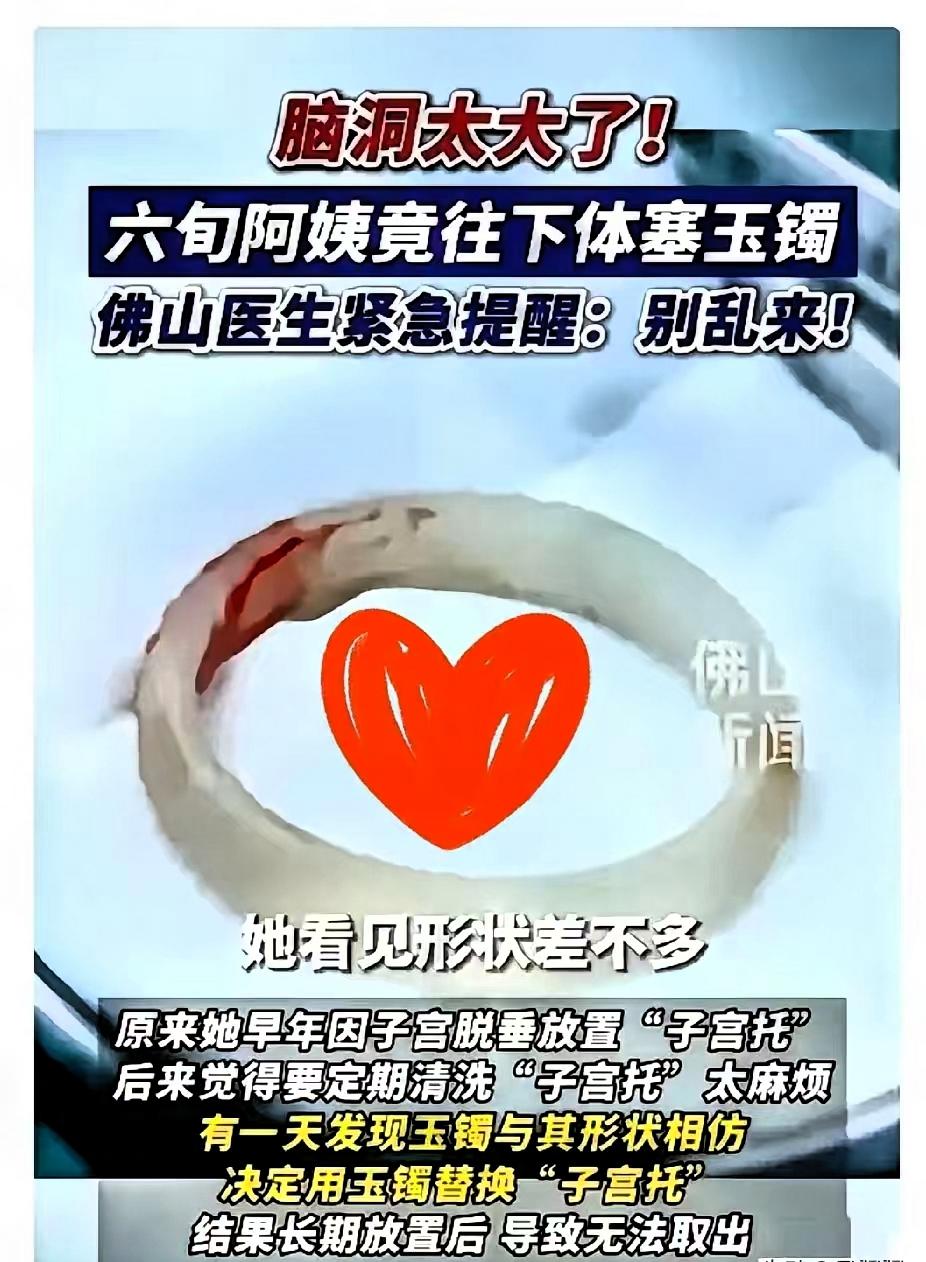“聪明反被聪明误！”广东，一65岁阿姨因为“阴道异物”去医院检查，结果医生发现里