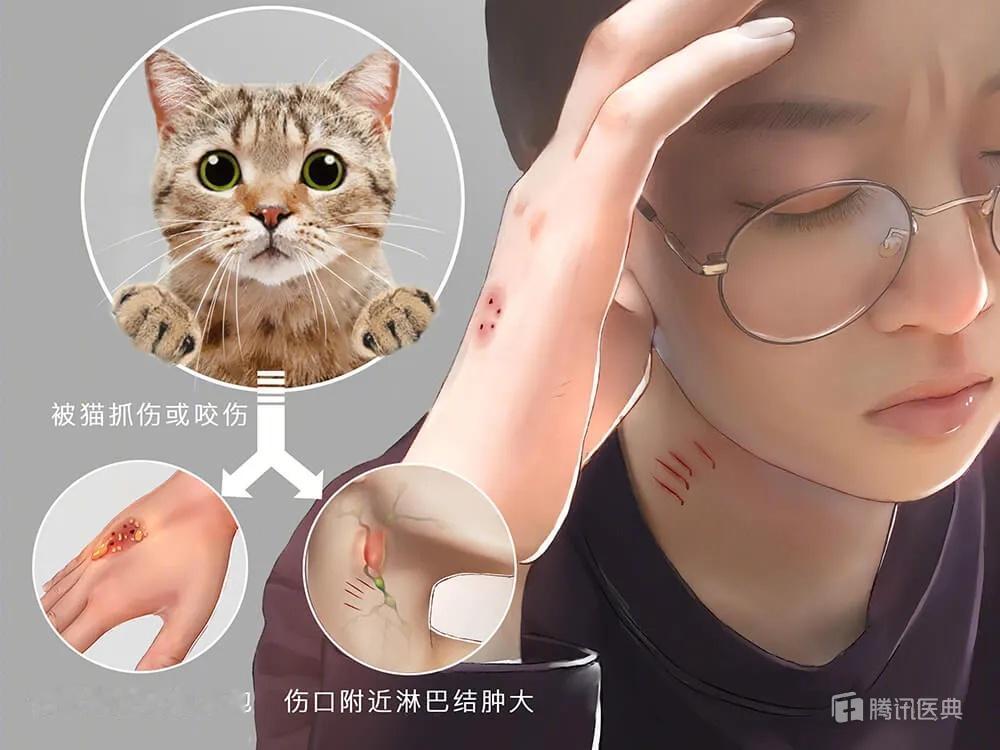 “这下后悔了吧！”2024年10月，上海，一年轻男子在喂食流浪猫时，不慎被流浪猫
