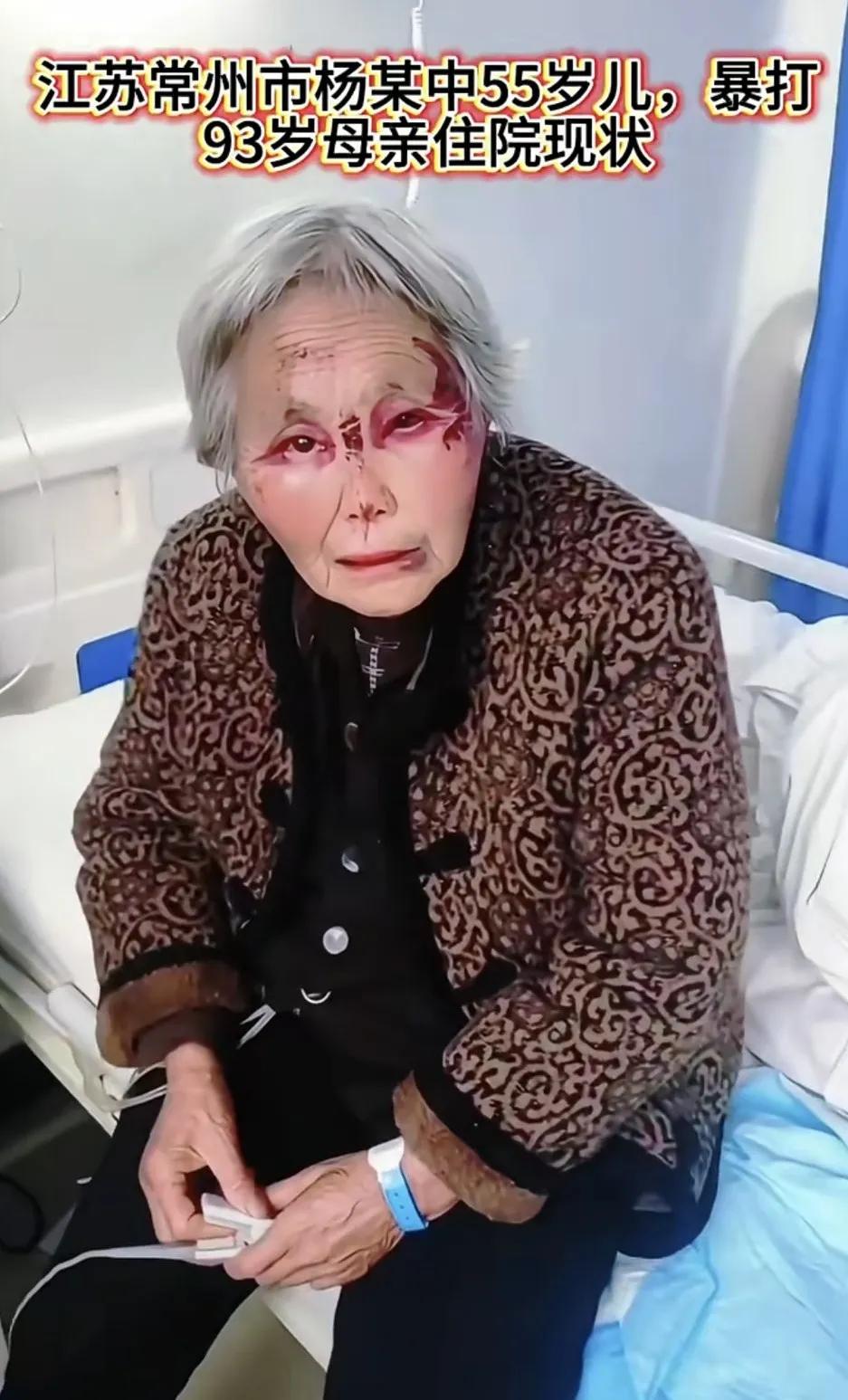 “惯子如杀子”，可怜之人必有可恨之处！被儿子打成这样，她心里还惦记着儿子。儿