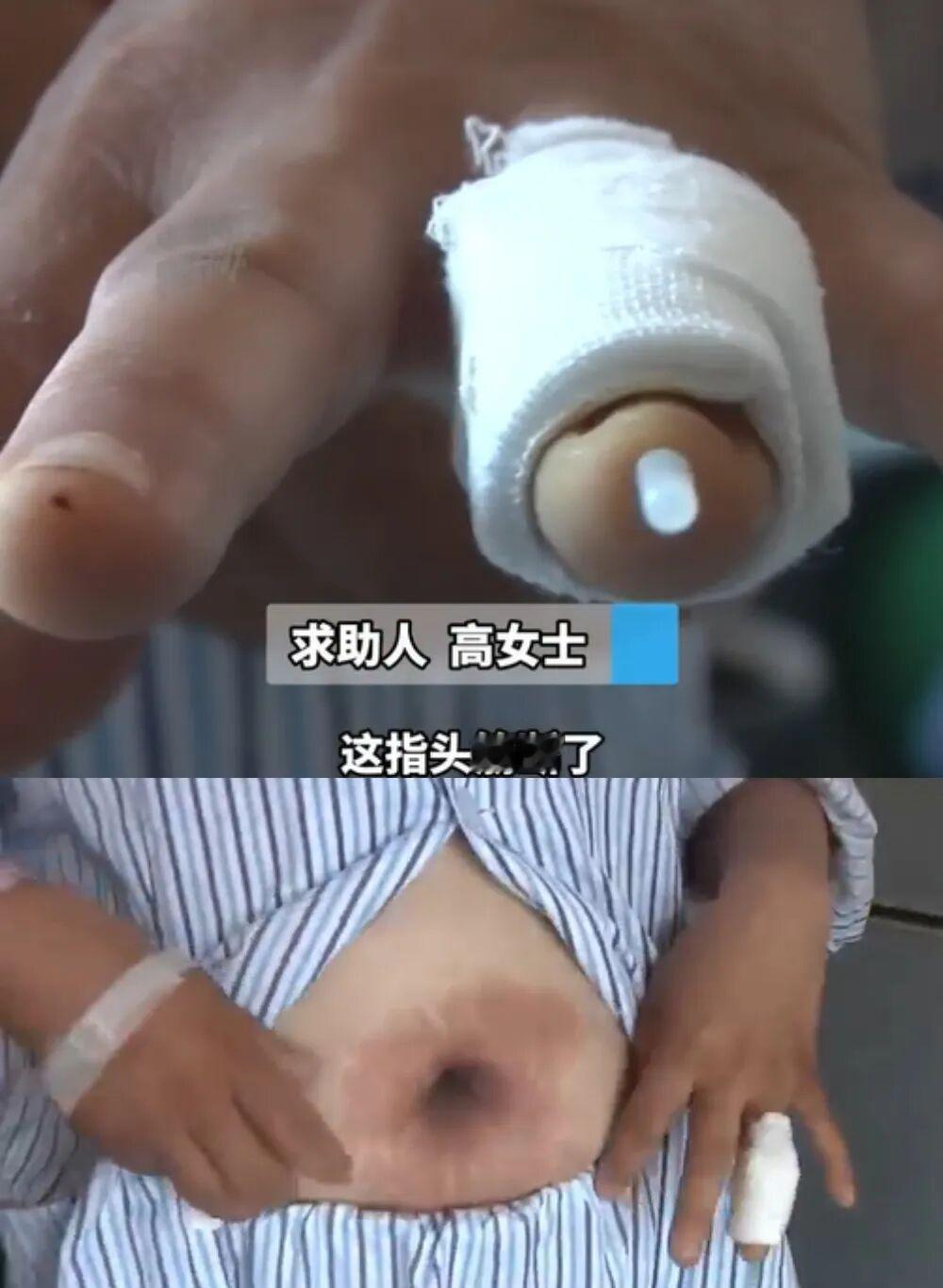 10块钱不是大钱，但因为10块钱闹到动手伤人，这事搁谁身上都想不通。登封的高女士
