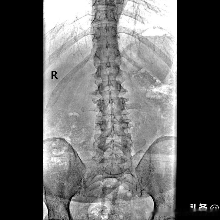 办公室久坐一族如何护腰？养成科学坐姿是“久坐族”护腰的基础，核