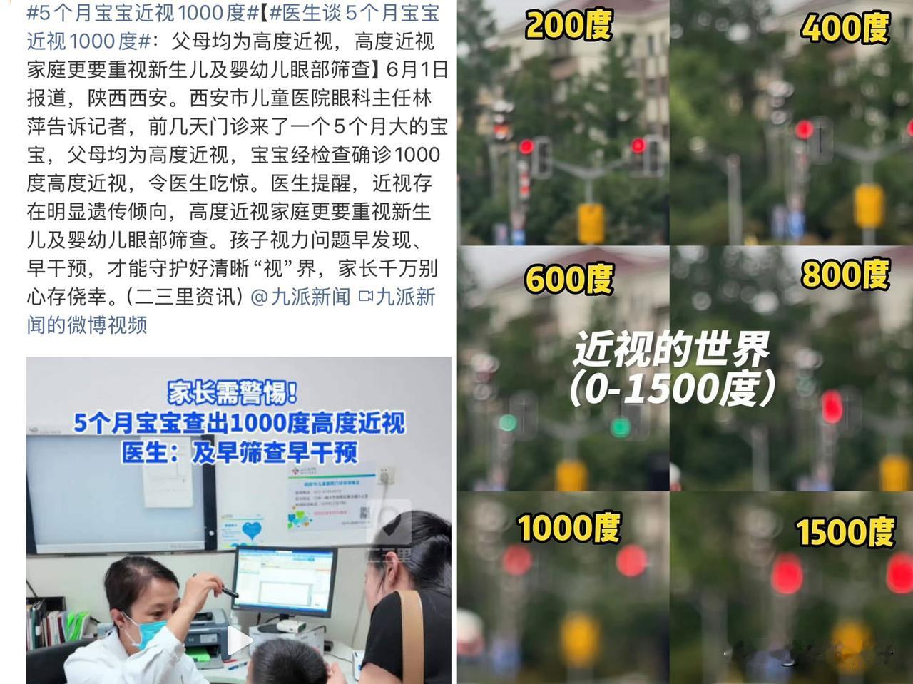 5个月宝宝先天1000度高度近视冲上热搜，根源不在电子产品，是遗传惹的祸近
