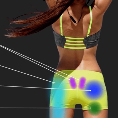 臀部后侧疼痛可能是什么原因【臀部后侧疼】来给大家整理一波常见原因——👉骶髂关