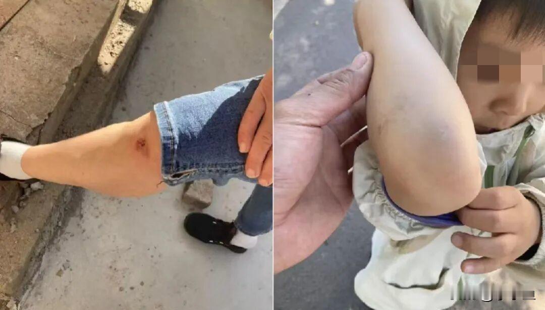 台铃电动车方向把频繁锁死，老人接孙险遭二次伤，售后难断症结谁能想到，买辆新电
