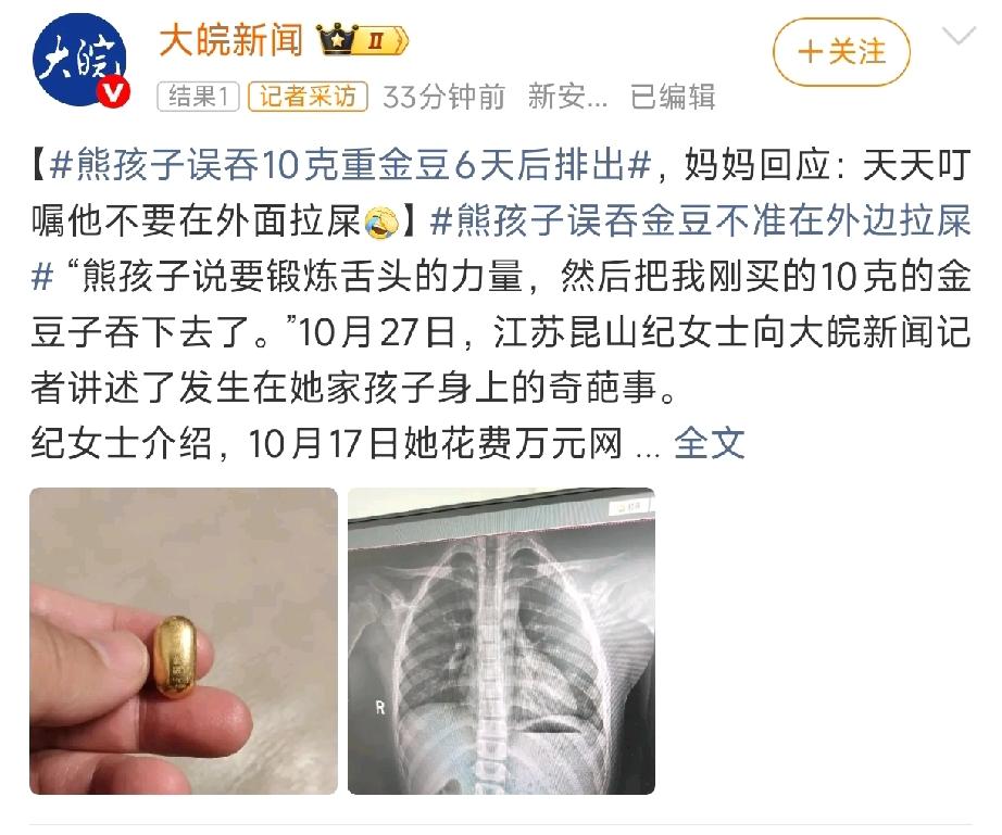 孩子误吞金豆,妈妈叮嘱别在外拉屎事情发生在10月21日,纪女士花了一万元网购