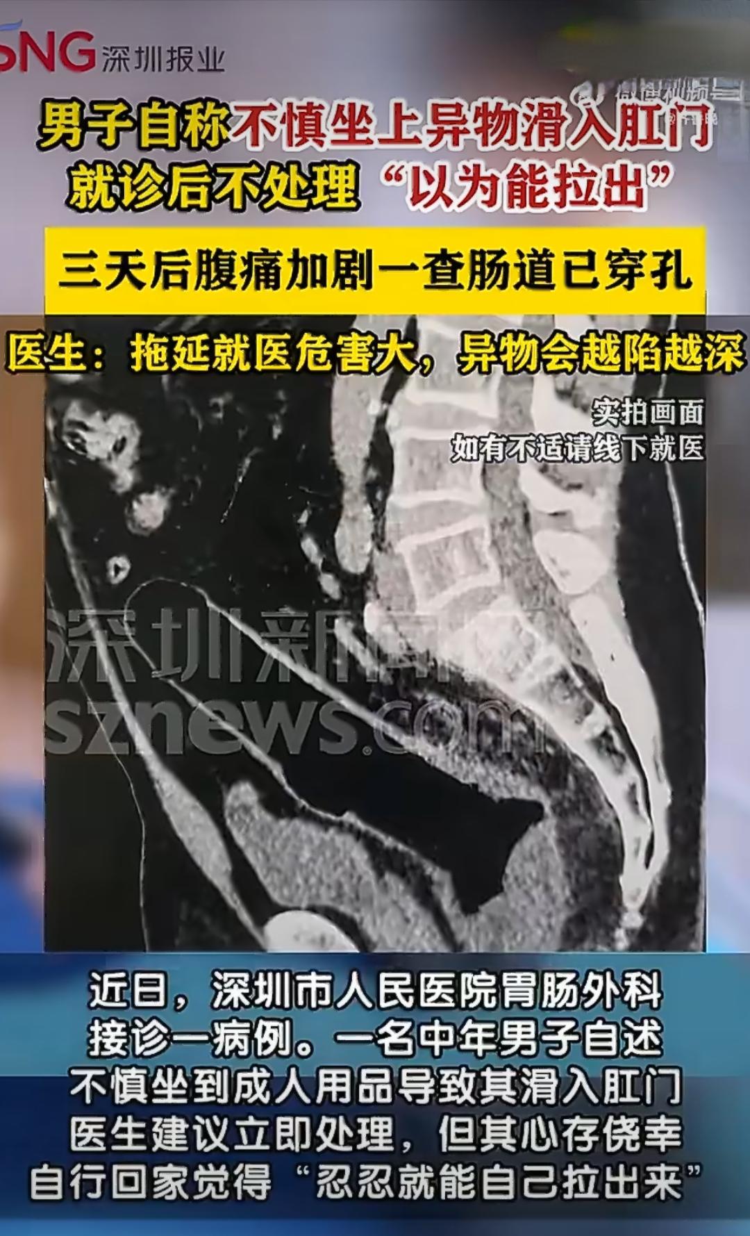 在广东深圳，有这么一件事挺让人唏嘘的。一名有个中年男子，也不知道怎么就不小心