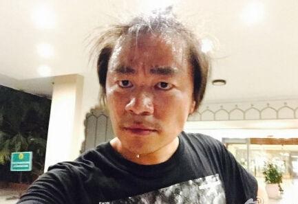 为什么会无缘无故脱发?