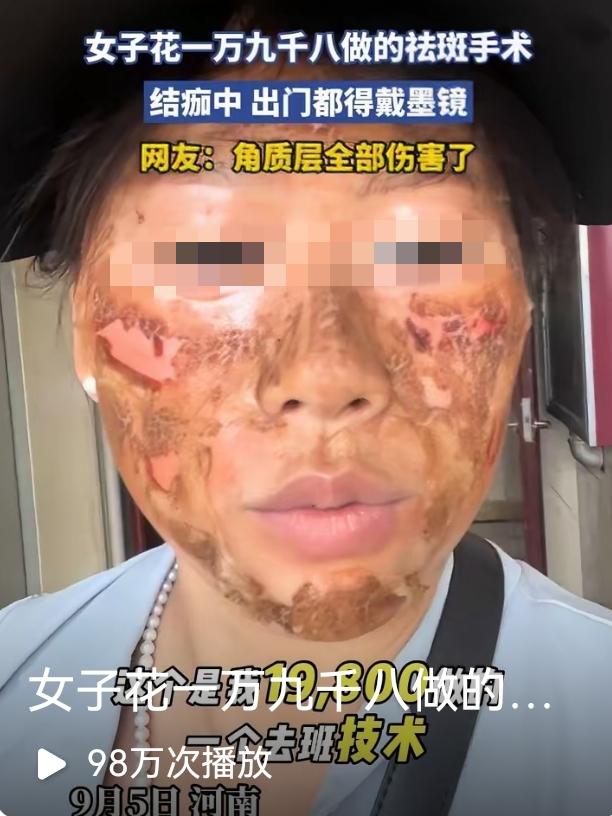 花19800祛斑反毁容！河南女子脸肿脱皮不带墨镜不敢见人，这事给所有爱美姐妹