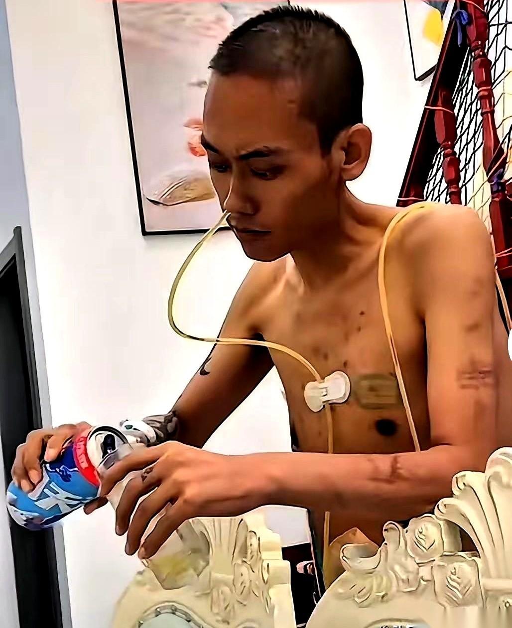 他身上还插着各种管子，就这么光着膀子，举起一瓶啤酒，笑了。妻子在旁边哭着劝，说