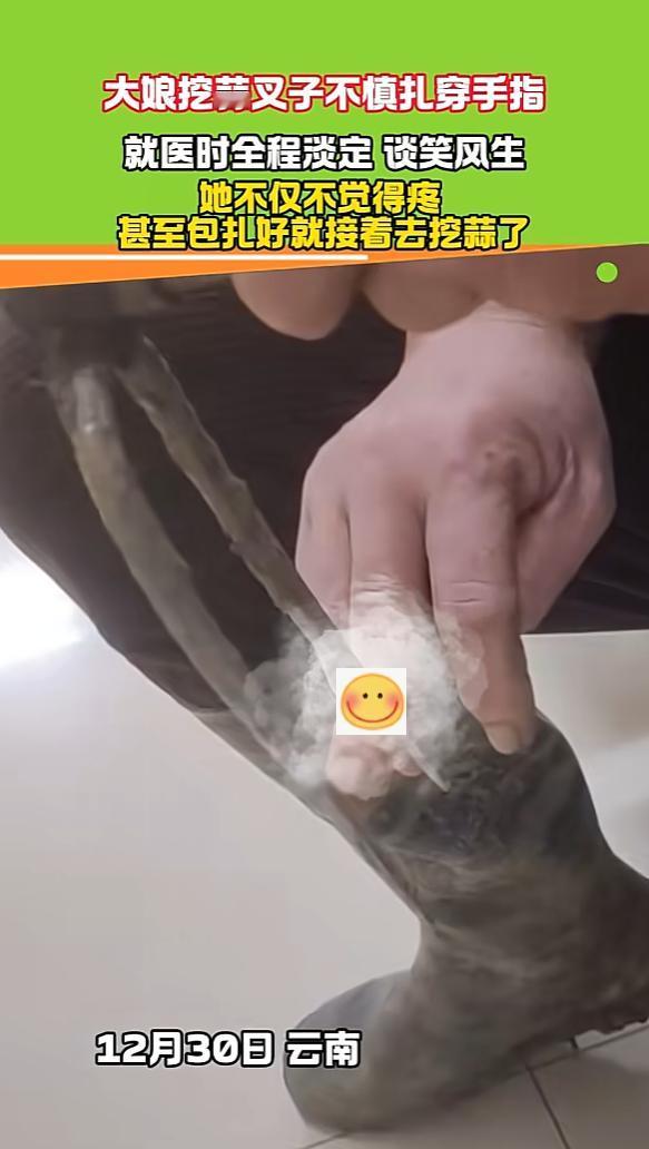 “这心态没谁了！”12月30日，云南，一大娘用叉子挖蒜时，不小心将手指扎穿，去诊