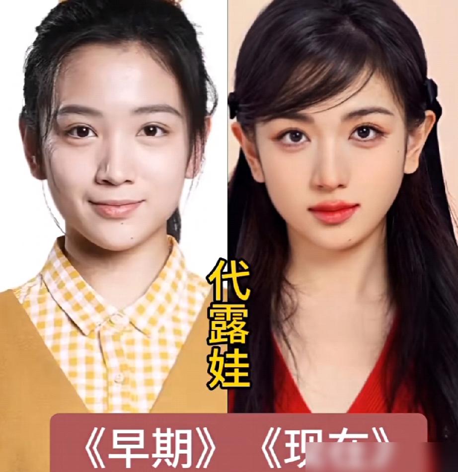 真不是我黑，虞书欣那张脸，镜头一怼生图，高光油得像抹了猪油。GQ红毯上，那