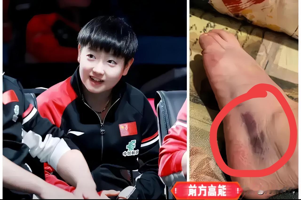 隔着屏幕都疼！孙颖沙比赛意外摔伤，网友：赛场等得起，好好养伤！那声清脆