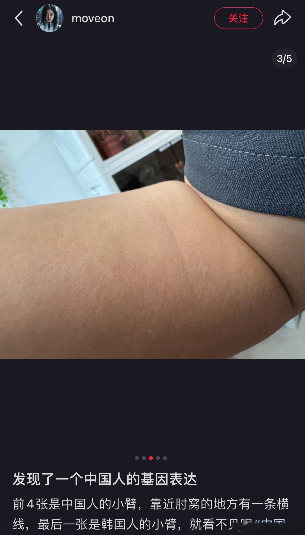 涨知识了！原来胳膊上有“线”是纯种汉族人的标记😳我看了一下我有哈哈哈哈哈哈