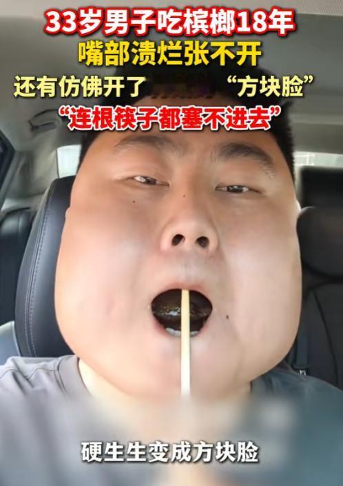 太吓人了！6月7日报道，湖北一男子嚼了18年槟榔，几乎天天不离口，硬生生把脸嚼成