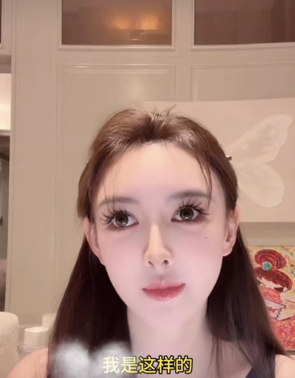 家人们，叶珂又杀回大众视野啦！这次不是因为恋情，而是直播里一番医美省钱经，直接炸