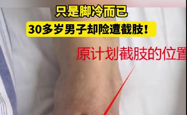 30多岁男子总觉脚冷险遭截肢别把小不适拖成大麻烦有没有人跟我一样，天一冷就手
