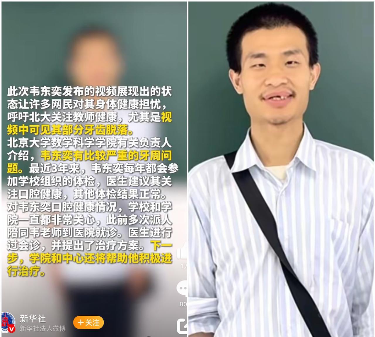 一觉醒来，北大不再沉默了，竟然真的出面解释了，韦东奕牙齿和身体健康问题。北