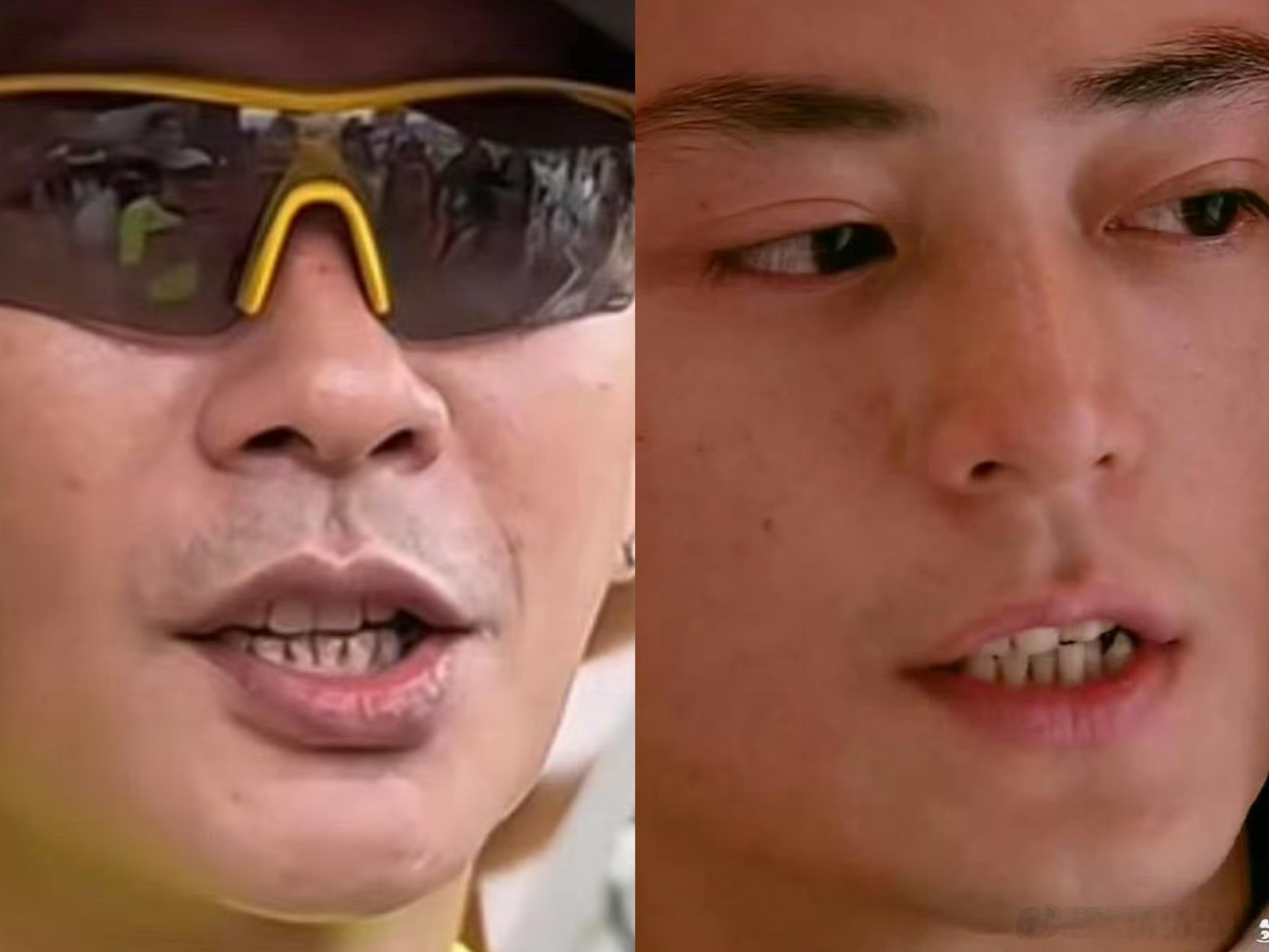 黄宗泽牙龈萎缩为什么男神的牙这样，粉丝还幻想和他们亲亲吗？