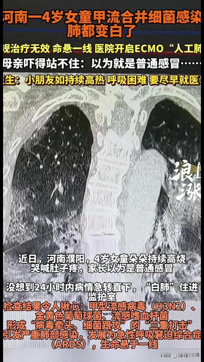 揪心！河南4岁女童甲流引发白肺，24小时内命悬一线真的看完后背发凉！河南濮