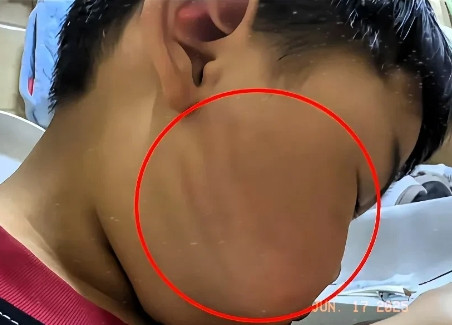 “我说孩子还小，打他不怕打出毛病吗？亲奶奶竟然说‘打孩子就叫教育孩子’，我气得把