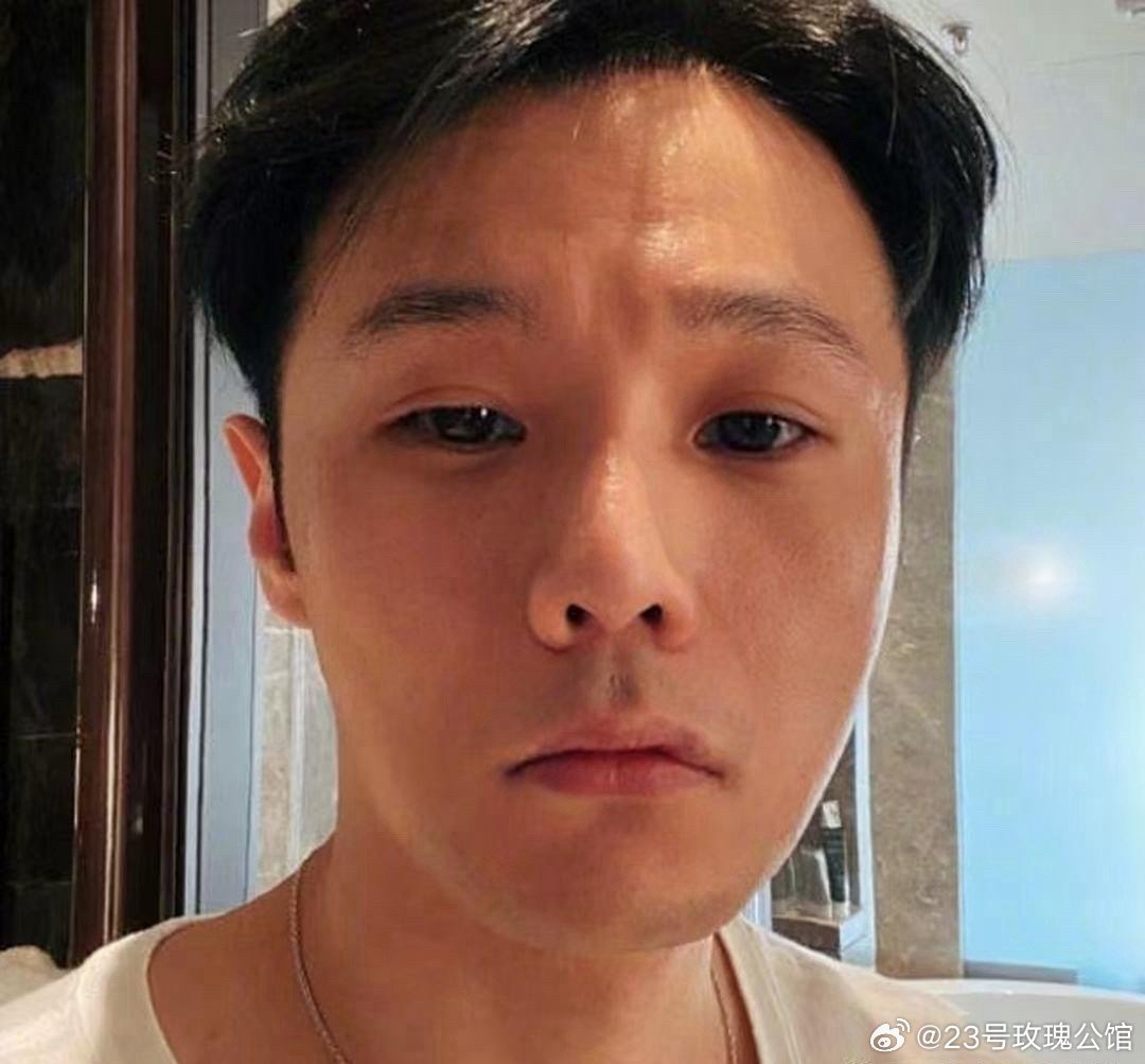 李荣浩割了双眼皮后，颜值一下子就上去了，可再也没有以前那种让人看一眼就知道是他的