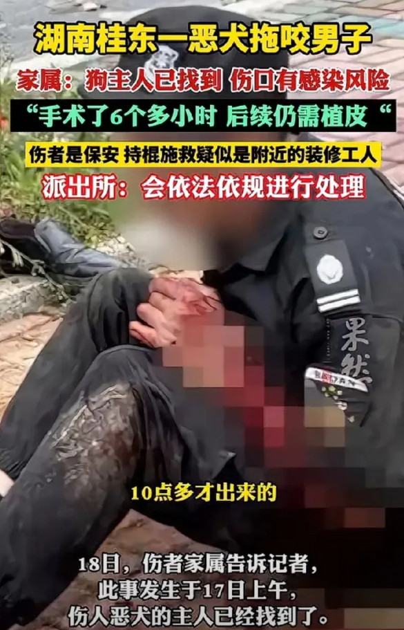 被恶狗咬伤的保安做了6个多小时手术，后续还要植皮，还有感染的风险。保安那么大只，
