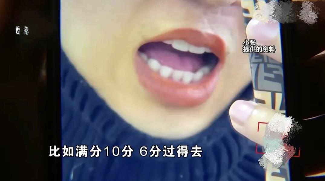 杭州，男子喜欢一男明星，觉得他嘴唇粉粉的好看，花4288元，做了同款纹唇，3年后