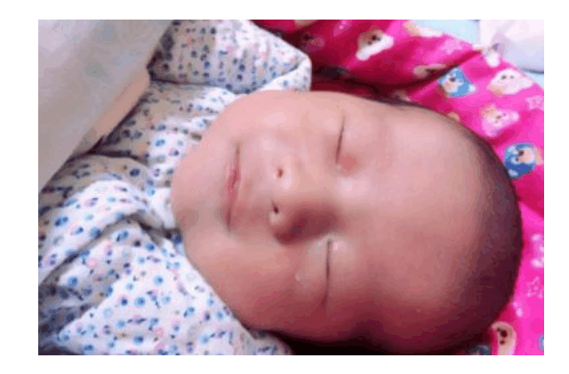 5个月的孩子不会抬头! 去医院检查医生说怎么不早点送来