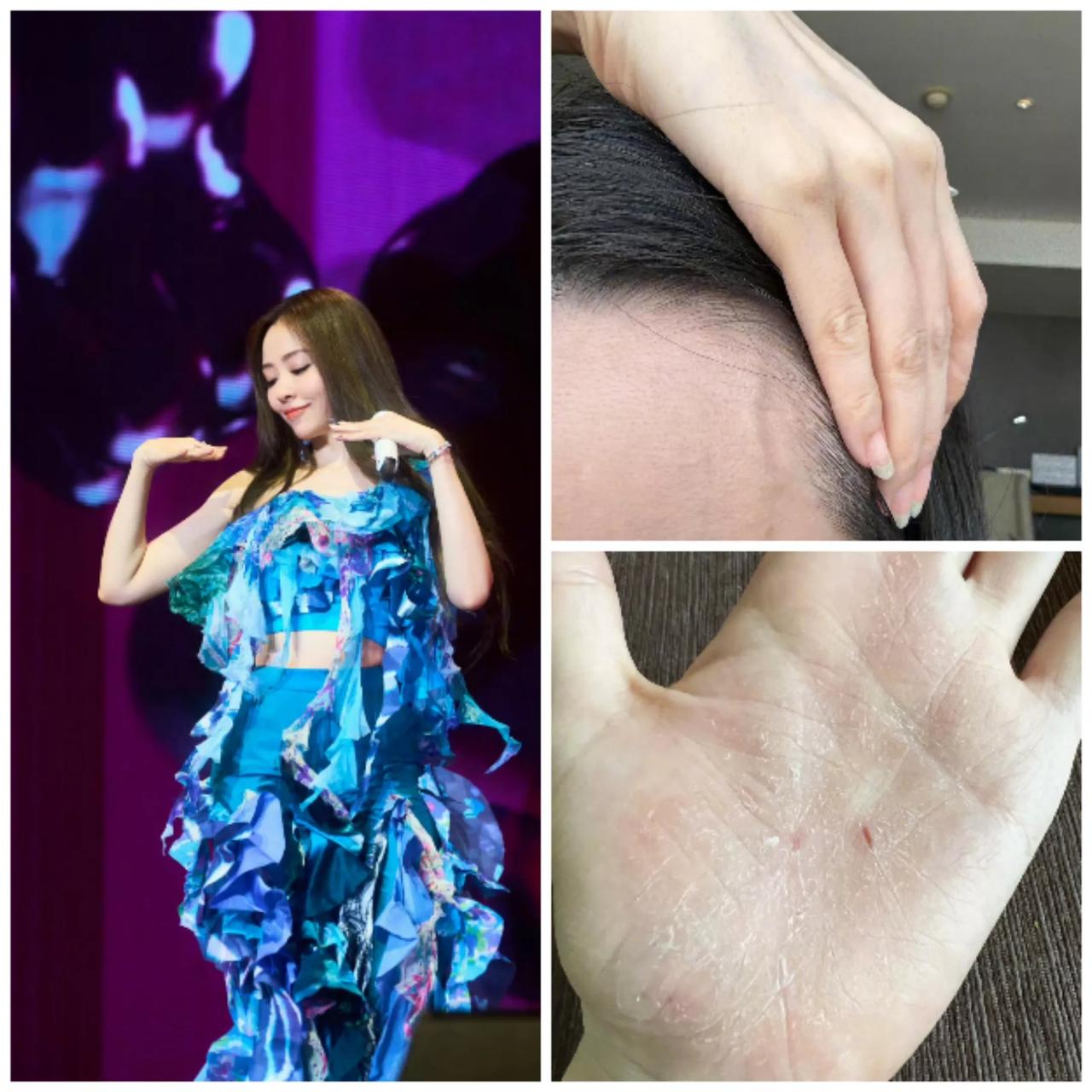 真是万万没想到，张靓颖看起来这么仙这么美，体检居然是营养不良，不仅额头时有青筋凸