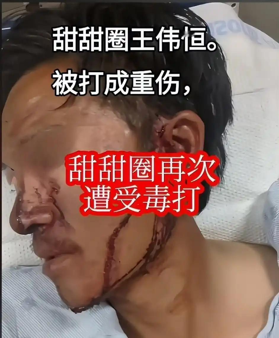 这真是太讽刺了！曾经高喊“甜甜圈真好吃，美国人真好”的王伟恒，竟然在郊外公园营