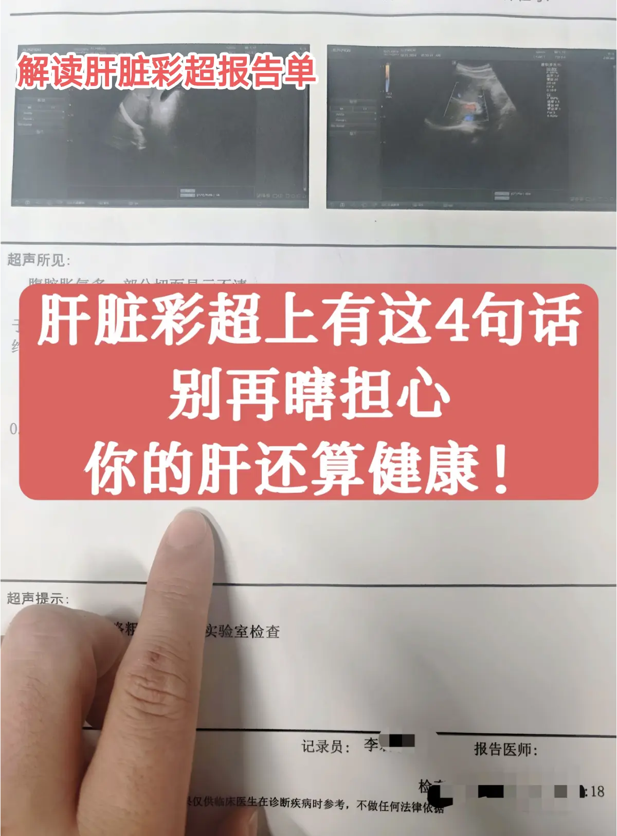 如果你的肝脏彩超报告上有这4 句话，那就别再瞎担心了，说明你的肝还算健...