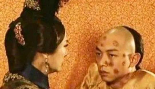 公元1874年9月，太监在给同治帝洗澡的时候，发现他瘦如骷髅，肩背等处有很多斑疹