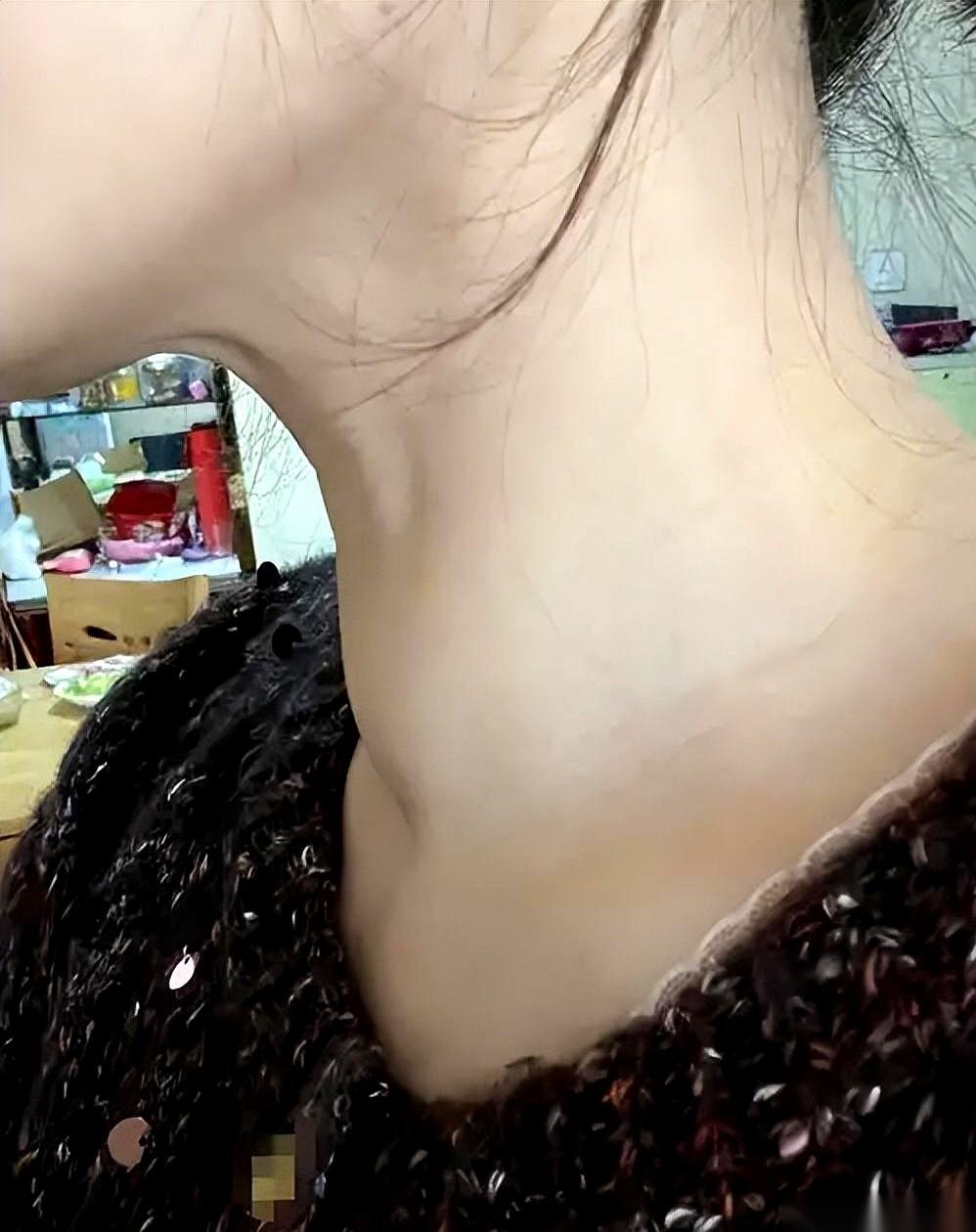 聊起甲状腺结节或甲亢，大多数人的第一反应往往是“缺营养了，赶紧补补”。于是，有人