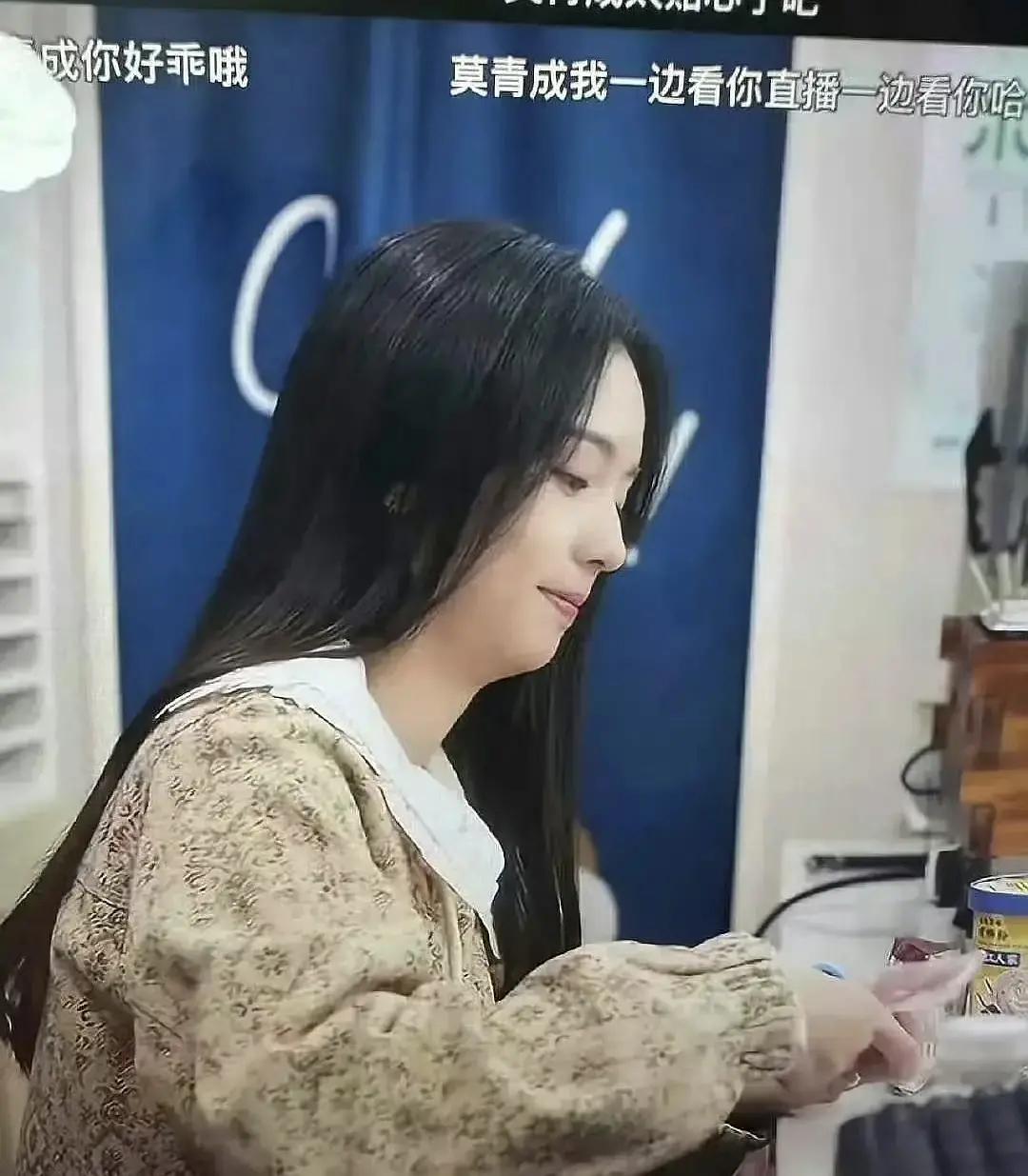 原来明星也有下巴后缩的问题啊，周也这种下巴后缩还有办法改善吗？感觉下巴后缩已经影