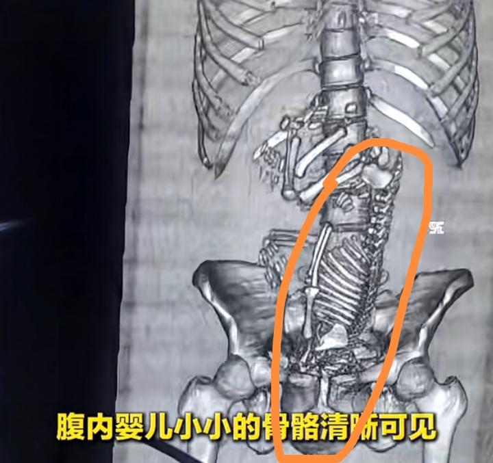 19岁小姑娘腹痛就诊2小时后分娩，一扒发现这女生嘴最真硬：医生接二连三的询问，