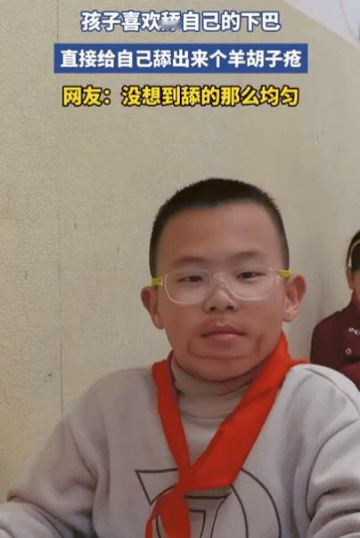 笑不活！浙江有个小男孩，不知从啥时候起，养成了舔下巴、舔嘴唇的毛病，家长瞅着只当