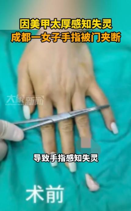“这下后悔了吧！”5月底，四川成都，一女子为了好看，在自己的手指上做了很长的美甲