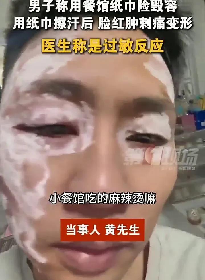 “差点毁容了！”近日，安徽一名男子去小餐馆吃麻辣烫，期间用餐馆提供的纸巾擦汗，用