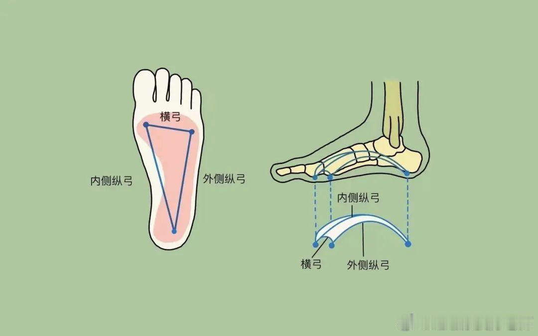 扁平足足弓很平怎么办？我的孩子已经8岁了，足弓还是比较塌，是怎么回事呢？今天我