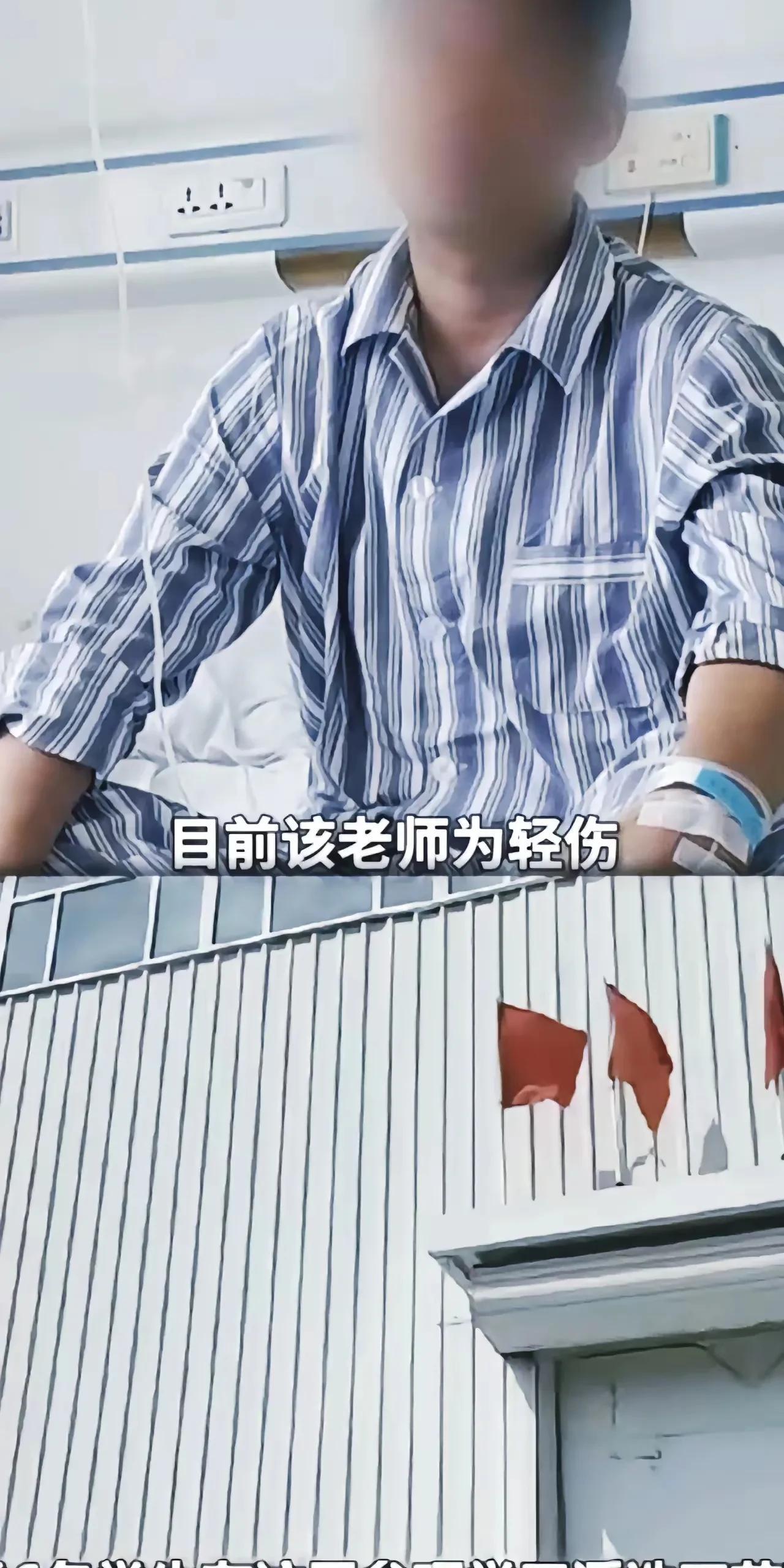 掉进浮#浮选槽#选槽的老师终于发声了，当初自己掉进去了一半，被钢筋卡住了，可惜
