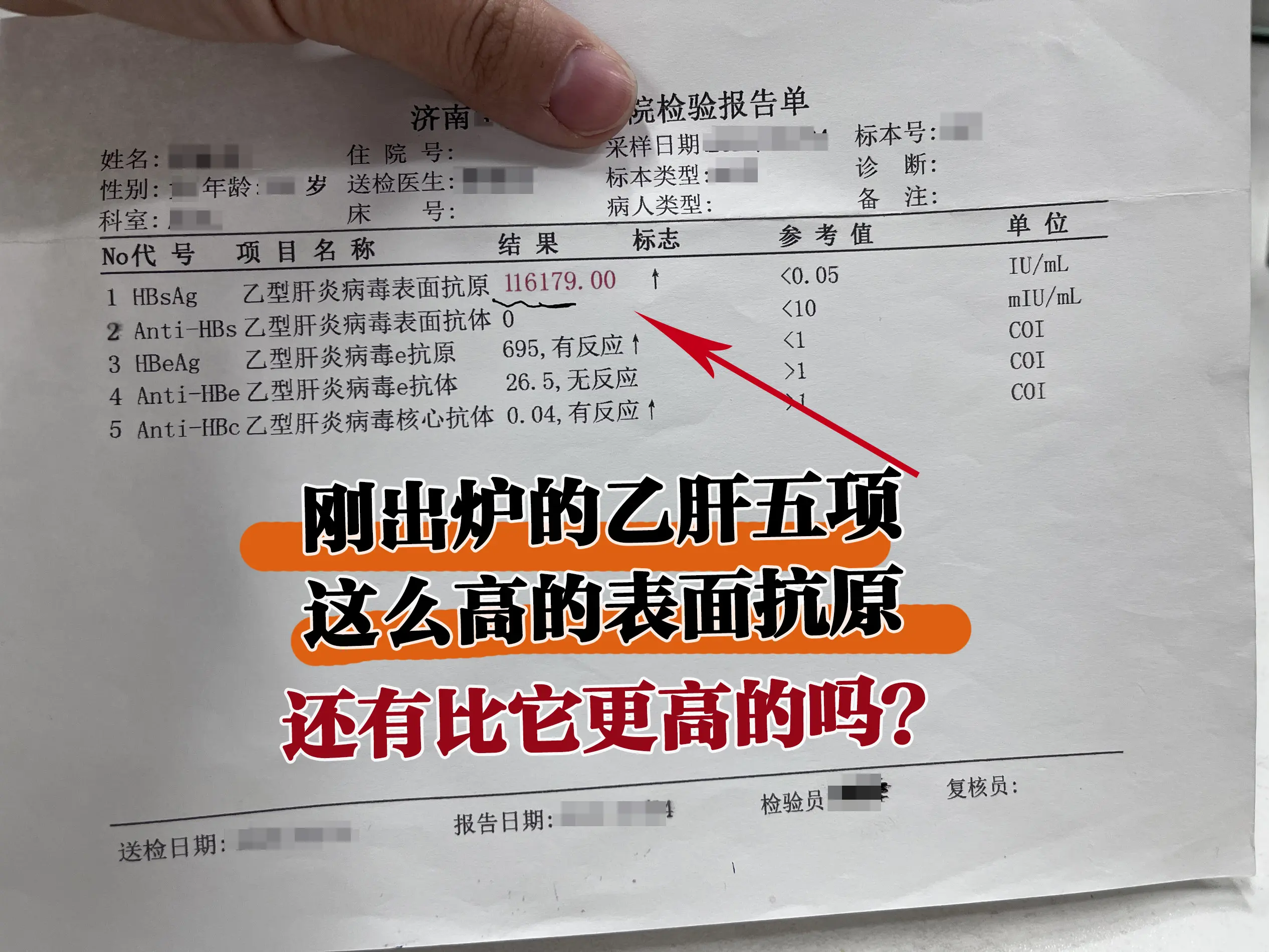 这位朋友刚拿到乙肝五项结果，看到表面抗原11万多，被吓坏了，以为很严重...