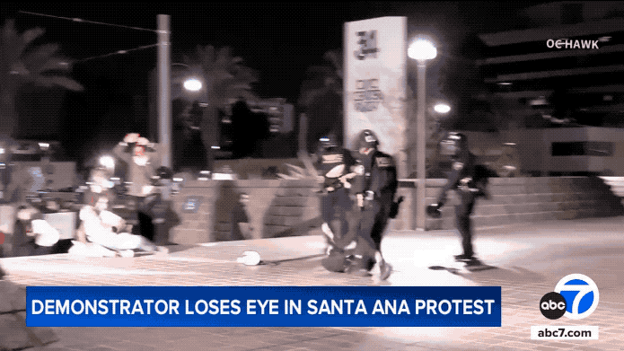 21岁美国男子参加反ICE示威：被打瞎一只眼后半辈子彻底成为废人，你们觉得他值吗